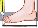 Damskie sandały Sanital Flex 8024.17 red, lekkie, miękkie, elastyczne, tegość G-H-J